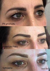 20-PMU-Pudrove-oboci-